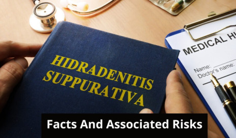 Hidradenitis Suppurativa Facts And Associations You NEED To Be Aware Of